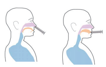 igc ims呼气分析仪